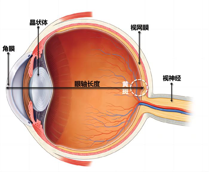 1754274284795349.jpeg 轴性近视眼球