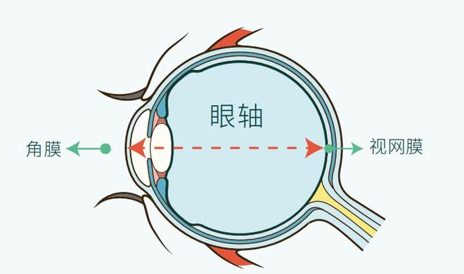 孩子眼轴长但近视度数低，需要担心吗？